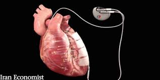 رابطه ضربان قلب و تصادف مشخص شد