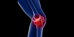 مهم‌ترین علائم روماتیسم مفصلی