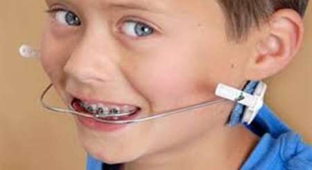 بهترین زمان اولین معاینه ارتودنسی