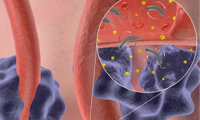 ابداع نانو ذره‌ای جدید با قابلیت عبور از سد خونی مغزی