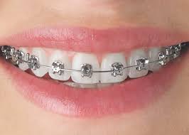 مهم‌ترین اهداف درمان‌های ارتودنسی