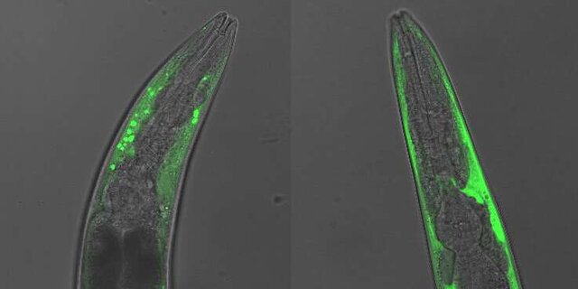 یافته‌های جدید دانشمندان درباره بیماری پارکینسون