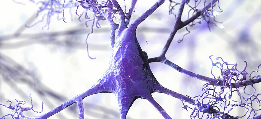 دانشمندان ازکشف علت جدید ابتلا به آلزایمر مغز خبرمی دهند