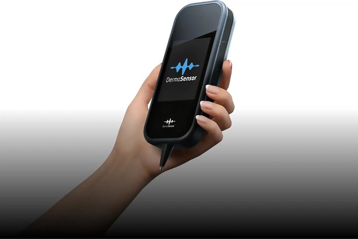 هوش مصنوعی 3 نوع سرطان پوست را تشخیص می‌دهد