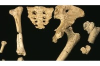 انسان در مراحل تکامل دچار دردهای لگن، شانه و زانو شده است