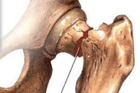 مفیدترین ورزش برای پوکی استخوان چیست؟