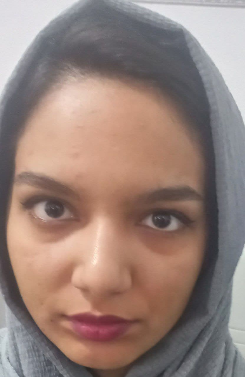 آیدا احمدی قهرمان پیشرفت از زرند