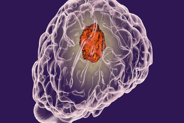 وقتی الکتریسیته به درمان سرطان تبدیل میشود!