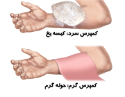 خون‌مردگي و کبودي پوست